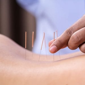 Instituto Internacional de Kinesiología Raquel Campanales - Curso Presencial de Kinesiología y Acupuntura zonal